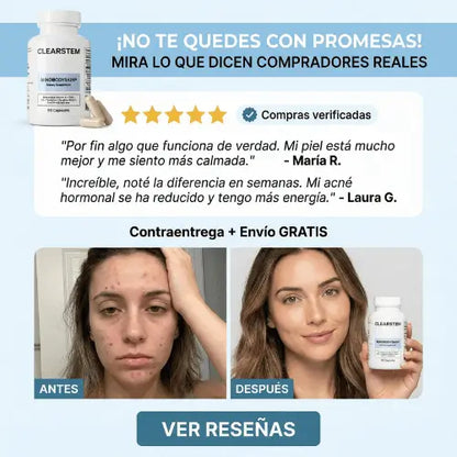 CLEARSTEM® La raíz de tu piel más estable: apoyo interno diario.