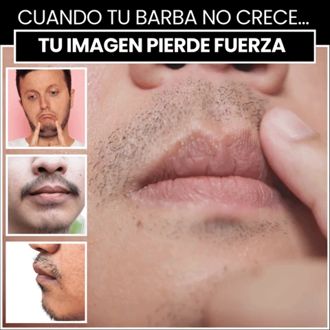 BARVAN — Densidad en Zonas Lampiñas | Minoxidil 20% + Péptidos