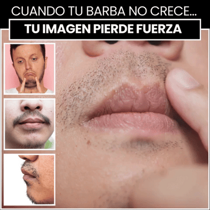 BARVAN — Densidad en Zonas Lampiñas | Minoxidil 20% + Péptidos